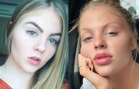 Maybe you would like to learn more about one of these? Mudancas No Rosto De Mulher De Whindersson Nunes Chamam Atencao Veja Antes E Depois