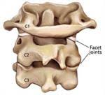 Usually a locked facet can be unlocked. Facet Pain Hinterland Physio