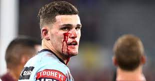 Wighton has improved over the year but he is not in the same league as cleary. First Blood Nathan Cleary Into State Of Origin Folklore With Brave Effort Nrl