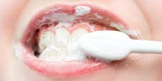 Como Blanquear Los Dientes Con Bicarbonato O Neill Now