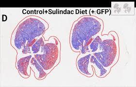 Image result for Sulindac