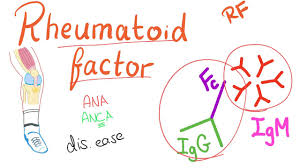 Image result for Rheumatoid Factor