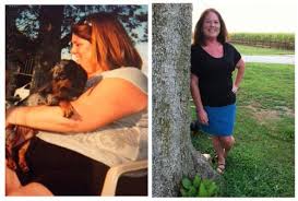Hypothyroid In Photos Before And After Stop The Thyroid Madness