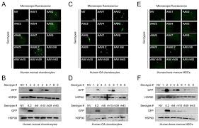 Image result for White 1997 AAV