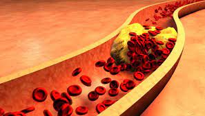 There is good news though: Tiny Robots Can Clear Clogged Arteries Innovation Smithsonian Magazine
