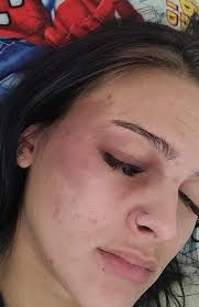 Police probe continues into Nambour alleged attack