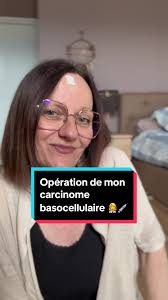 Opération de carcinome basocellulaire sur le front