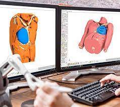 Die häufigkeit bei geburt ist etwa 1:20.000 bis 1. Behandlung Des Poland Syndroms I Anatomikmodeling