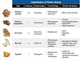 Image result for Calcium Nephrolithiasis