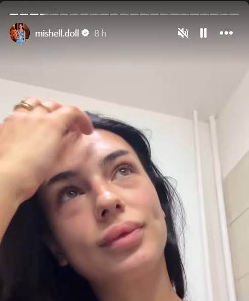 FOTO Mišku z Ruže napadla priateľka jej ex manžela. Zachraňovali ju okoloidúci - Svetevity.sk