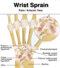 What Is Piriformis Syndrome Example Grow Health