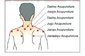 Chinese Acupuncture Points For Pain Relief Download Scientific Diagram