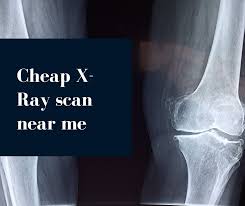 Pricing for patients without insurance. Cheap X Rays Near Me Cost Of X Rays Without Insurance