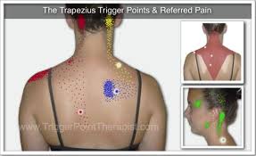 Pin On Referred Pain