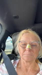 I know I need to be careful what I post but a lot of people are messaging  me to see how I’m doing after being beat up. Surgery