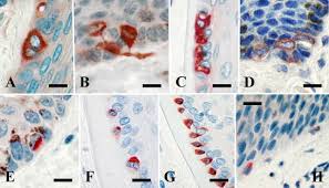 The following tests are used to identify merkel cell carcinoma, and to determine its stage (how far the disease has. Morphologic And Immunohistochemical Features Of Merkel Cells In The Dog Sciencedirect