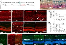 An inflammatory process is linked to the onset of experimental diabetic retinopathy. Conditional Muller Cell Ablation Causes Independent Neuronal And Vascular Pathologies In A Novel Transgenic Model Journal Of Neuroscience