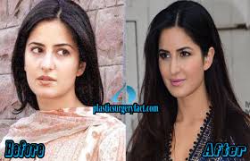 Katrina Kaif Plastic Surgery Before And After Photos Plastic Surgery Facts Download the pinkvilla app for latest bollywood & entertainment news, hot celebrity photos, lifestyle articles, fashion. katrina kaif plastic surgery before and