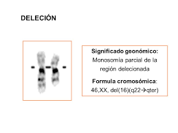Aqui você encontra 4 significados da palavra parcial. Alteraciones Cromosomicas Estructurales Ppt Video Online Download