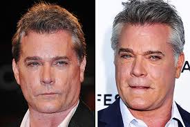 Goodfella ray liotta has sparked speculation of plastic surgery gone wrong after his weird face debuted on the red carpet. Top 20 Male Celebrities You Didn T Know Had Plastic Surgery Pop Hitz Celebrity Gossip News Latest Pop News Page 6