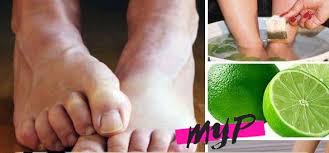Como Eliminar El Mal Olor De Los Pies Fisiomorfosis 2021