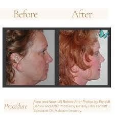 Malcolm Lesavoy's Instagram, Twitter & Facebook