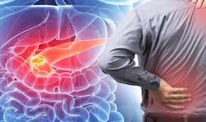 Since dogs usually show only mild warning signs, cases of hemangiosarcoma may not be detected until the cancer has reached an advanced stage. Pancreatic Cancer Symptoms Back Pain Could Be A Sign Of The Condition Express Co Uk