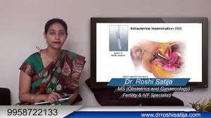 Copperman suggests that before you start the process you have a session. Intrauterine Insemination Fertility Treatment Iui Procedure Step By Step In Hindi Video Dailymotion