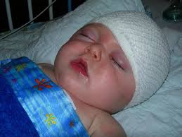 Cranio Family Support Group