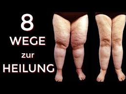 Lipodem 2 0 8 Wege Zur Heilung Coach Cecil Youtube Heilung Fitness Produkte Gesundheit