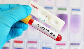 O principal deles é o tipo de teste. Anvisa Aprova Testes Rapidos Para Coronavirus Em Farmacias Medicina S A