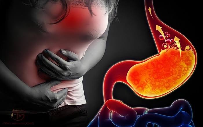 Bài tập tốt nhất cho người bệnh trào ngược dạ dày thực quản