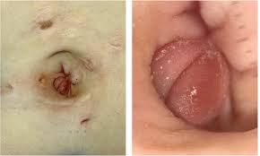 Image result for Umbilicus