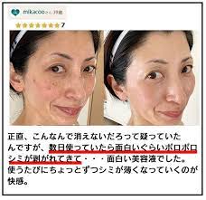 renacell 顔 シミ 消す 顔のシミ 顔
