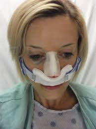 My Experience With Septoplasty Surgery Sinus Surgery Sinus Surgery Recovery Rhinoplasty Recovery