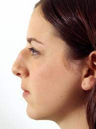 Noseforbeauty Big Nose Beauty Pretty Nose Big Noses