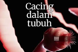 Dokumen, anak saya sangat sukar untuk dimakan. Awas Cacing Juga Serang Orang Dewasa