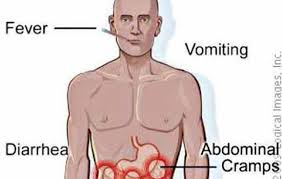 Typhoid fever has infected many people and was responsible for many deaths over the course of history, which continues to a lesser extent today. Protect Your Family From Typhoid Fever