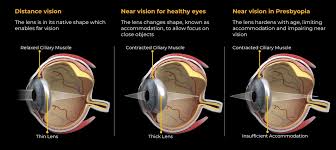 Image result for Presbyopia