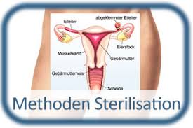 Die geburt per kaiserschnitt ist eine operation. Nach Der Sterilisation