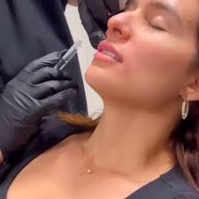 Dr Kiran Gill Patient Reviews Cosmetic Plastic Surgery Naples Florida