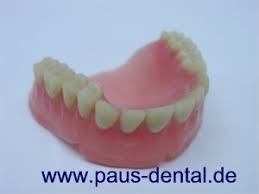 Ist ein zahn abgebrochen, kann dieses starke schmerzen hervorrufen und ist optisch ebenfalls unschwer zu erkennen. Antworten Zu Ihrem Zahnersatz Finden Sie Hier Www Paus Dental De