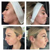 JESSI JAMES SKINCARE