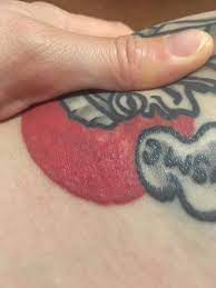 Dry skin by itself can cause rashes, so there's a chance it could be a total coincidence if one appears over a healed tattoo. Bumps On 1 5 Year Old Tattoo General Tattoo Discussion Last Sparrow Tattoo