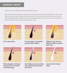 Laser hair removal cost by body area, laser hair removal pricing chart, nationwide network of hair removal specialists, tips for finding the best laser this means that laser hair removal prices in new york are not exactly the same as treatment costs in atlanta. 3 Wavelength 755 808 1064 Diode Laser Lightsheer Diode Laser Alma Laser Soprano Ice Titanium Platinum Xl Hair Removal Price Buy Diode Laser Hair Removal 755 808 1064 Permanent Diode Laser