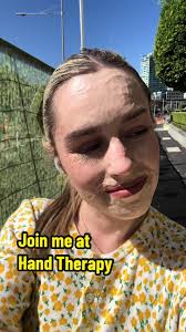 Hand Therapy Session and Butterfly Encounter