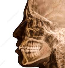 Image result for Skull XRay