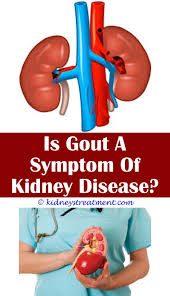 Dialysis And Hemodialysis Polycystic Kidney Disease Kidney Disease Stages Kidney Disease