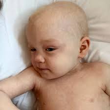 Mum says diet boosted son's cancer survival chances from 13 to 97pc