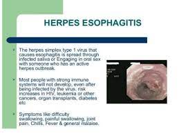 Commonly seen in aids patients. Herpetic Esophagitis